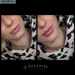 EstetiQ Patrycja Kordek